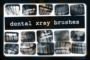 牙科X光射线影像PS笔刷 Dental X-ray Brushes